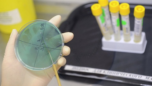 Анализ на тестостерон 529