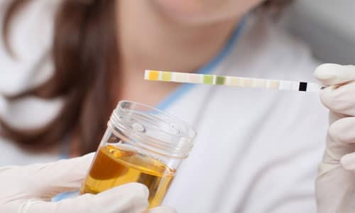 белок в моче