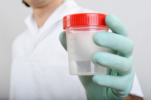 Лабораторные исследования спермы