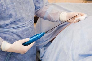 Подготовка к операции