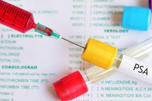 Уровень ПСА Уровень ПСА