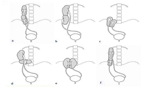Raznovidnosti pochechnoj patologii