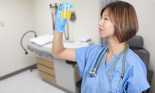 Анализ мочи