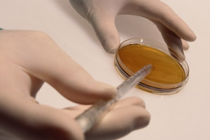 Анализ спермы