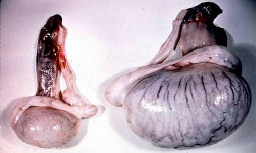 атрофия мужских яичек atrofija jaichek