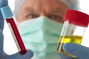 Сдача крови и мочи