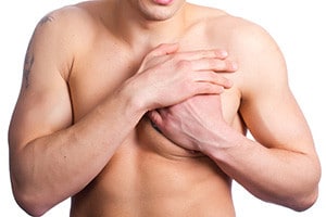 Признаки гинекомастии