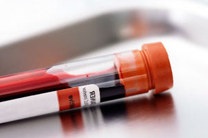 Анализ крови