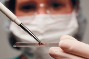 Лабораторные исследования мазка