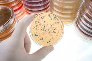 Анализ мазка