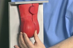 Диагностика яичек у мужчин