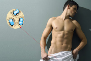 Признаки заболевания