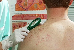 На приеме у дерматолога