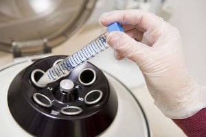 Спермограмма