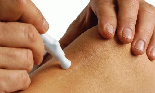 Так выглядит растяжка