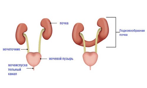 строение почки stroenie pochki