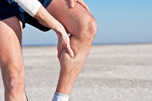 Варикоз нижних конечностей