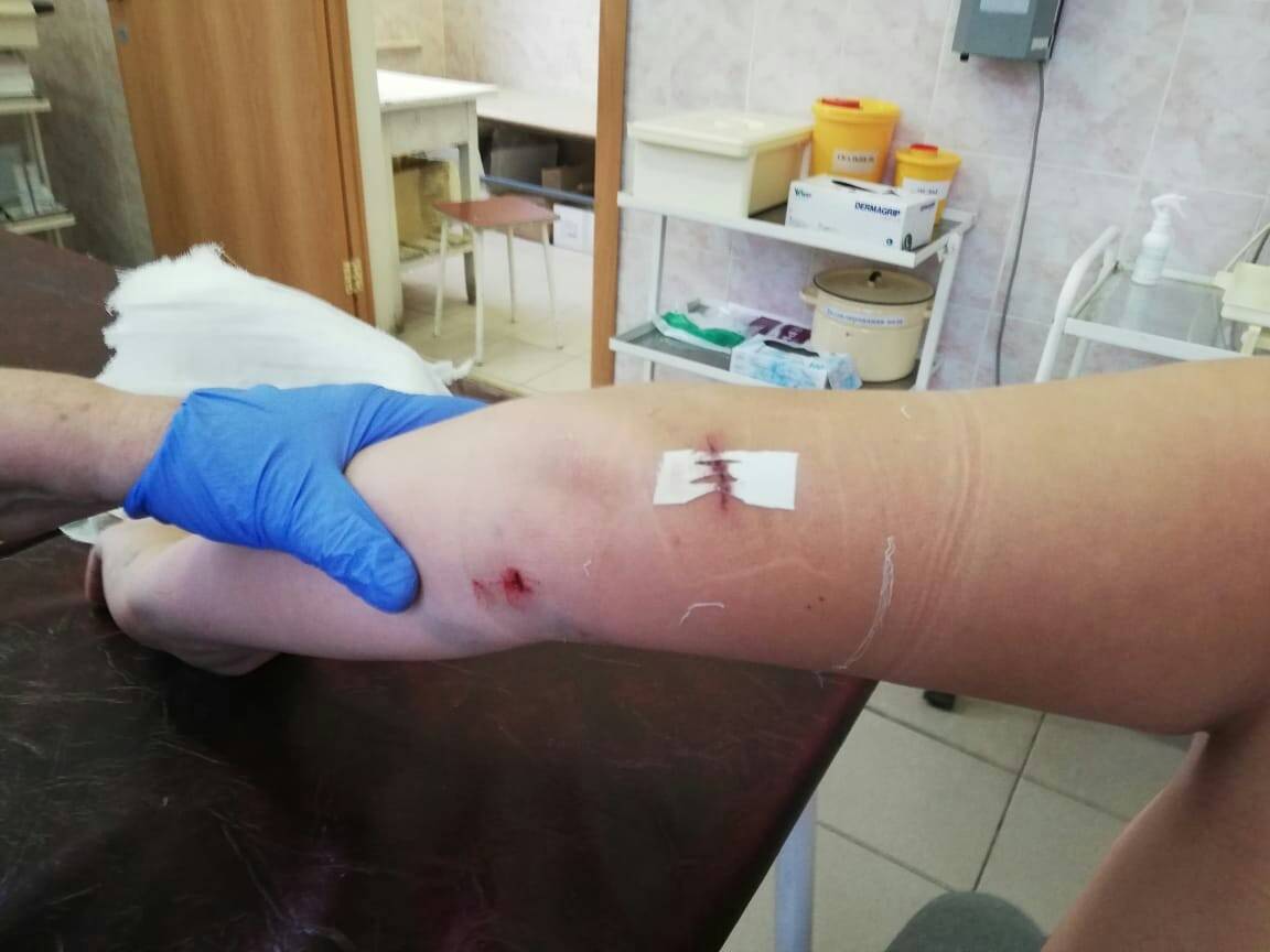 Что делать, если укусила собака: порядок действий, как возместить вред, куда обращаться