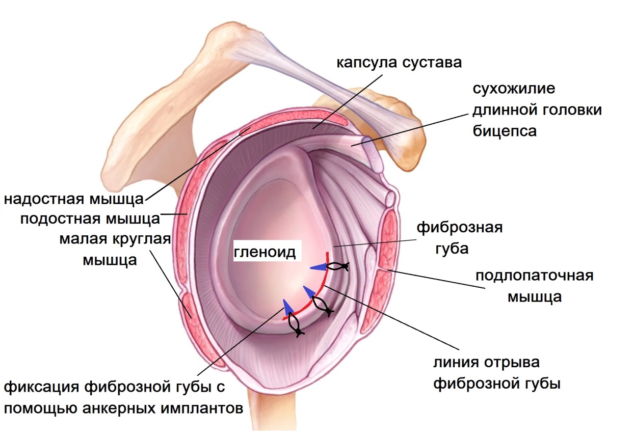 капсула сустава