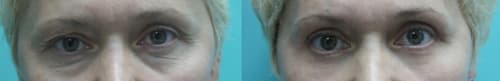 Eyes1.jpg Eyes1.jpg