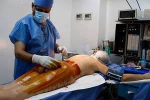 Пересадка кожи после ожога: как долго приживается, реабилитация, стоимость
