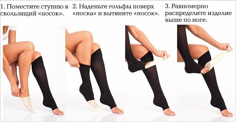 Как выбрать компрессионное белье при варикозе