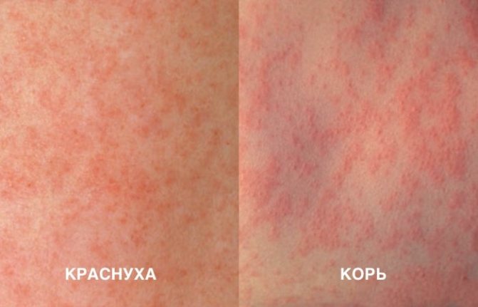 Не проходит синяк: почему долго на теле, может ли быть симптом заболевания, если на ноге, руке, теле, что делать