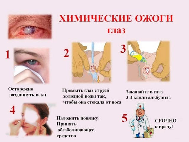 химические ожоги глаз