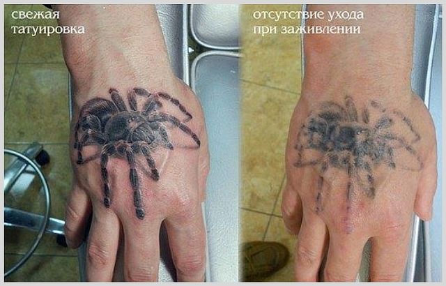 Отек после татуировки на ноге