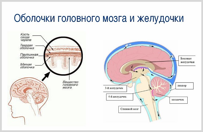 Почему увеличены желудочки головного мозга у грудничка